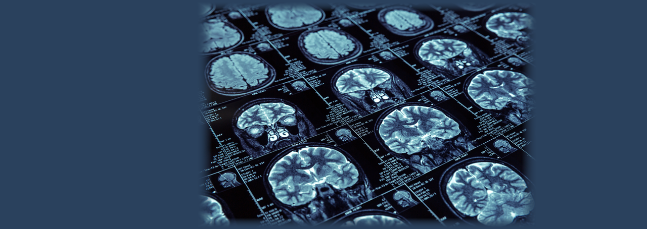 magnetic resonance imaging