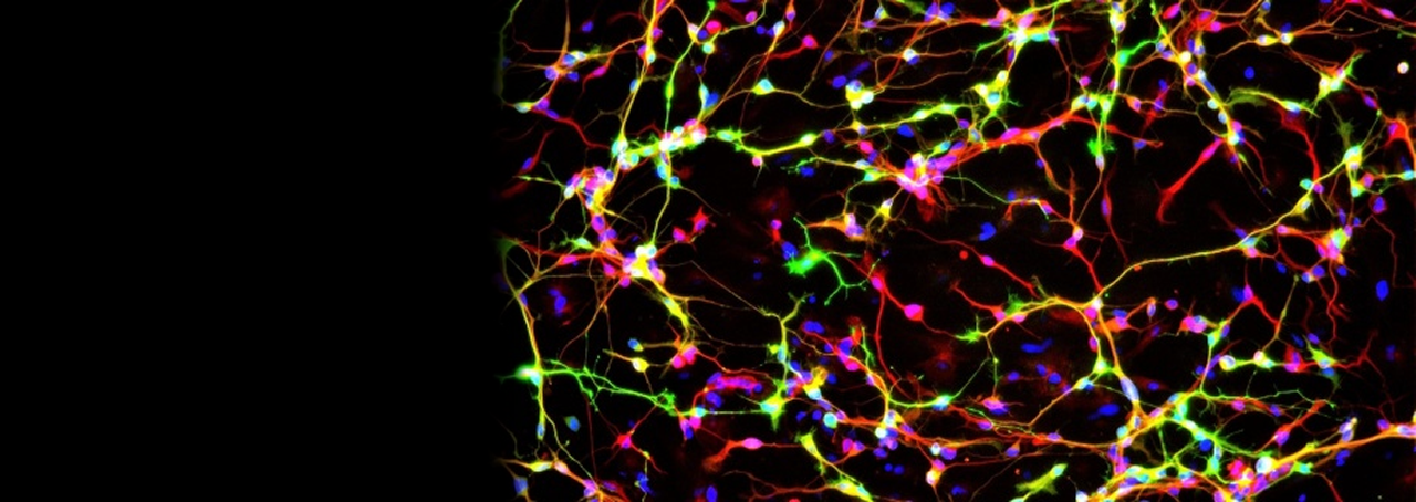 image of dopamine neurons