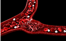 The sickle cells are shown in the center, with normal red blood cells depicted on the left and right