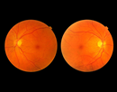 Color fundus photographs of the retina