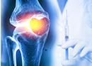 3d illustration of the anatomy of the human knee joint with a hand holding an injection